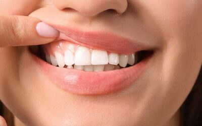 Steps you can take to protect your tooth enamel