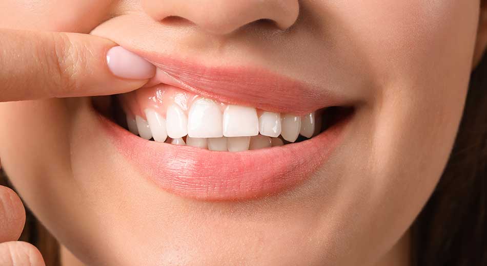Steps you can take to protect your tooth enamel