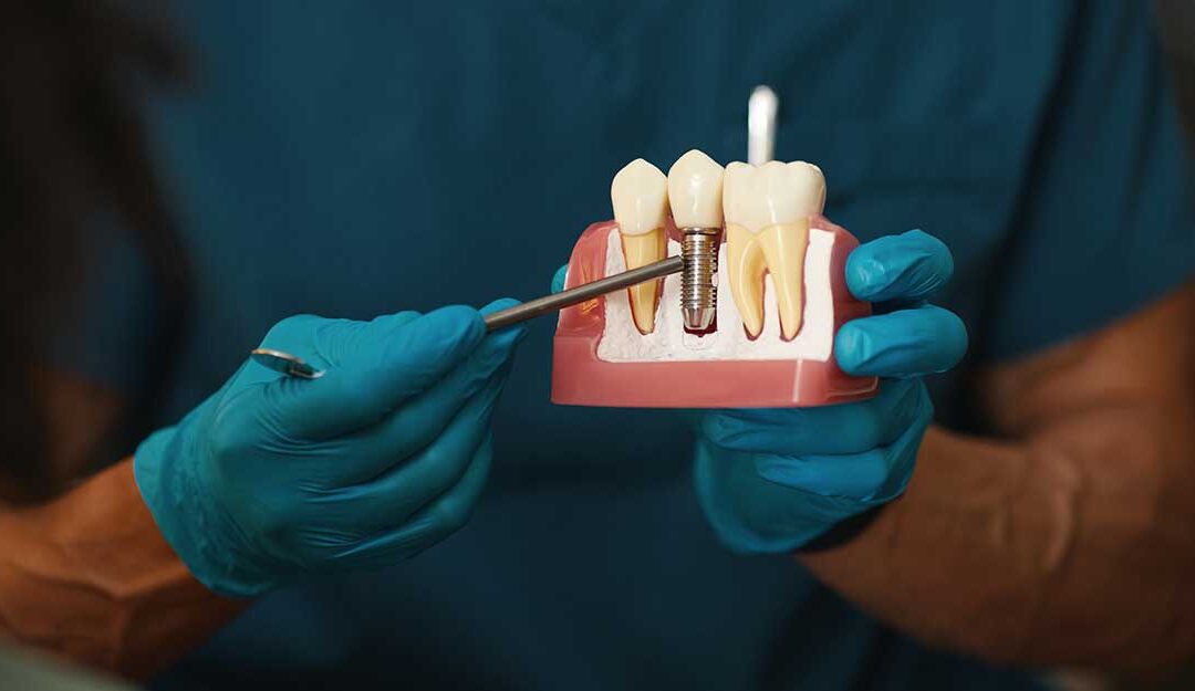 Could Dental Implants Be Right for You? Factors We Consider